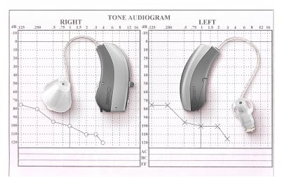 Maak een vrijblijvend audiogram